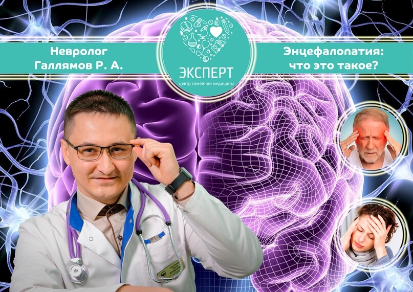 Эксперт врачи неврологи